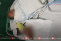 Santri korban kekerasan fisik oknum pengurus ponpes di Kudus. (Foto:JP)